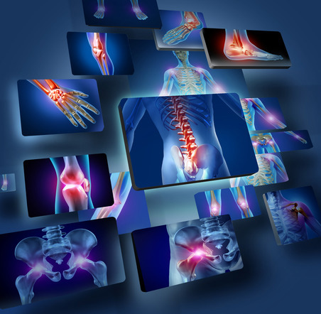 Common Chiropractic Problems & Conditions