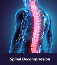 Spinal Decompression Chiropractic Treatment