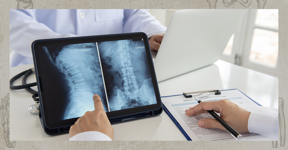 Herniated Discs and Chiropractic Care