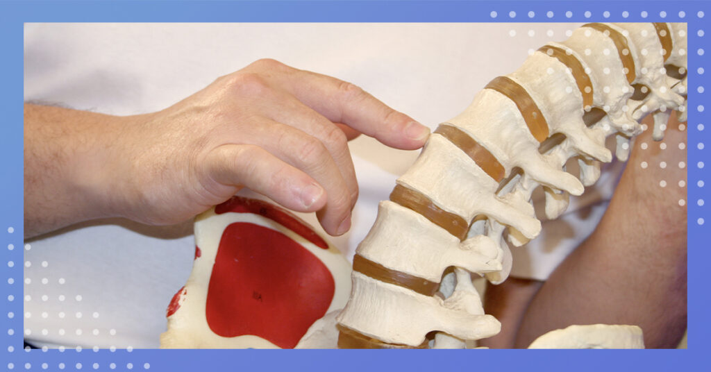 subluxation in the spine